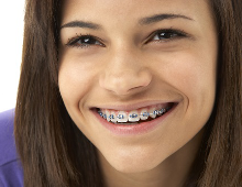 Orthodontist in Eindhoven